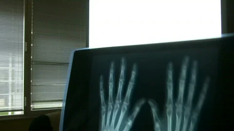Doctor reading x-rays Video stock 518681
