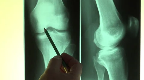 Doctor reading X-Rays pointing with a pencil - Full HD Vídeos de archivo 40255769