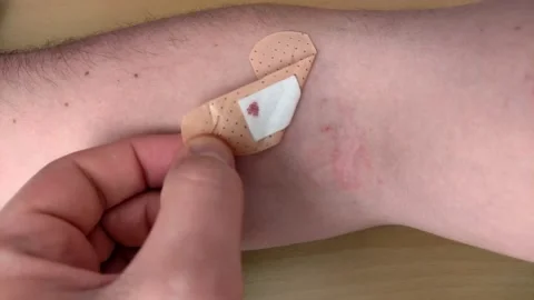 The doctor removes the patch from the patient's hand after taking blood Stockbeeldmateriaal 239609453