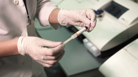 Doctor shakes syringe with blood before analysis Stock Footage 59509586