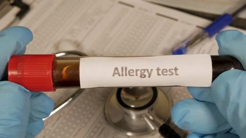 Doctor showing allergy test sample tube Stock Footage 312286978