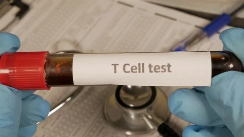 Doctor showing t cell test sample Stock Footage 312286975