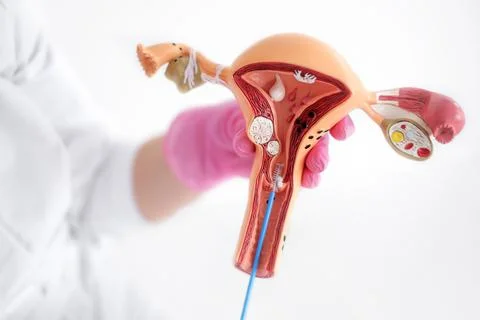 The doctor shows the process of taking an analysis on an anatomical model of  Stock Photos