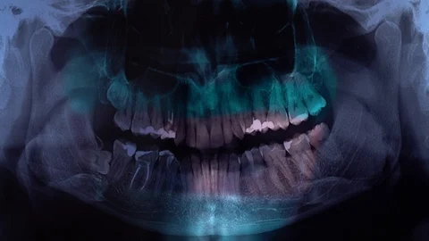 Doctor shows a teeth in a x-ray picture. A dentist holding an x-ray while Stock-Footage 101790688