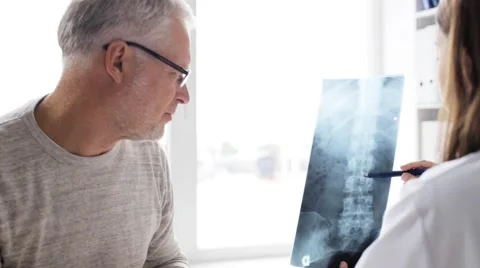 Doctor with spine x-ray and senior man at hospital  Stock Footage