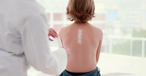 Doctor sticking patch test at her patient Stockbeeldmateriaal 49331116