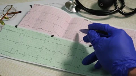 Doctor studies paper electrocardiogram, analysis symptoms and makes diagnosis Vídeos de archivo 263672656