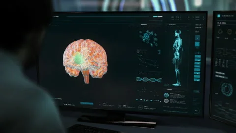 A Doctor is studying the brain tumor using the modern scanner system interface Video stock 169977807