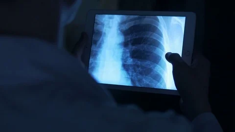 Doctor studying a chest x-ray Stock Footage