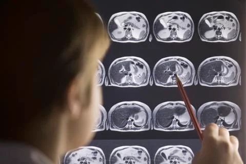 A doctor studying a MRI scan Stock Photos