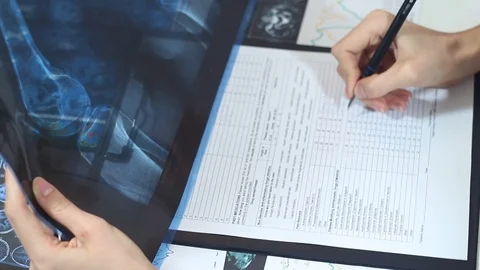 Doctor is studying with the X-ray of bones in the hospital Stock Footage 86690233