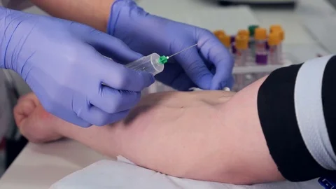 Doctor is taking a blood sample from a vein at a clinic. Close-up Stock Footage