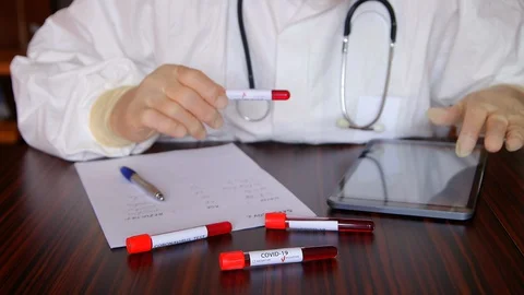 Doctor taking notes about the coronavirus positive tests from lab. 库存影片 128768662