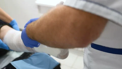 Doctor traumatologist puts a plaster on the broken leg of the patient. Stock-Footage 100605507