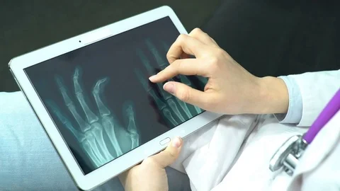 Doctor Use Tablet Computer and Controlling X-Ray Stock Footage 74526995