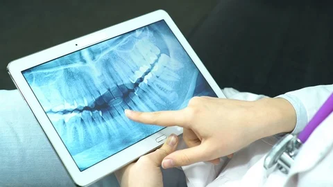 Doctor Use Tablet Computer and Controlling X-Ray Stock Footage 74527043