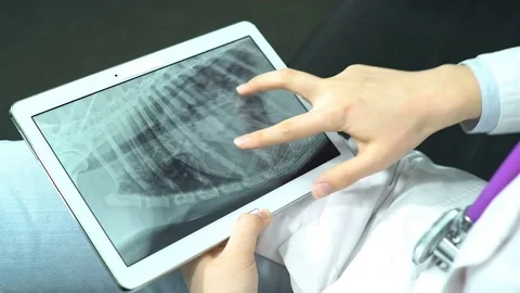 Doctor Use Tablet Computer and Controlling X-Ray Stock Footage 74527062