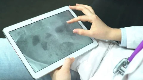 Doctor Use Tablet Computer and Controlling X-Ray Stock Footage 74527080