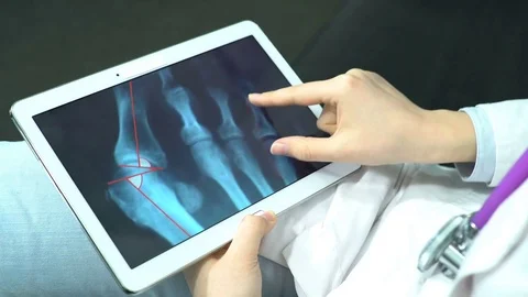 Doctor Use Tablet Computer and Controlling X-Ray Stock Footage 74527081