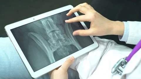 Doctor Use Tablet Computer and Controlling X-Ray Stock Footage 74527106