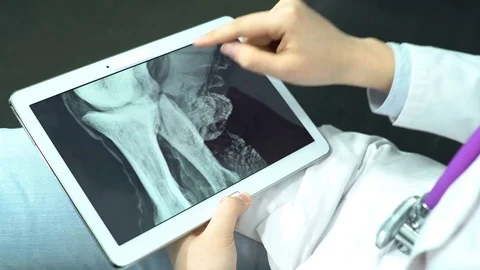 Doctor Use Tablet Computer and Controlling X-Ray Stock Footage 74527114