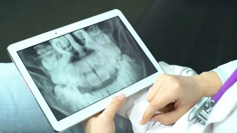 Doctor Use Tablet Computer and Controlling X-Ray Stock Footage 74527131