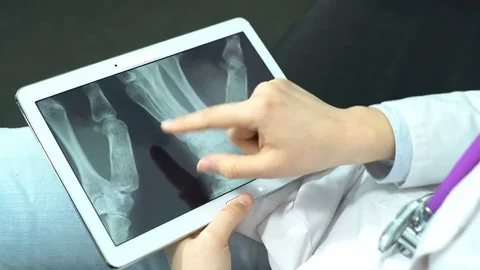 Doctor Use Tablet Computer and Controlling X-Ray Stock Footage 74527134