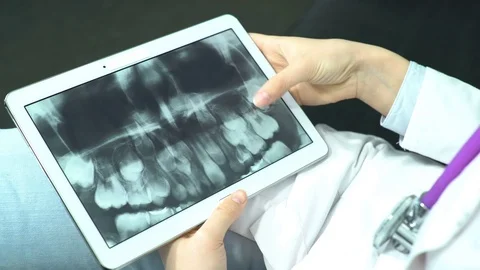 Doctor Use Tablet Computer and Controlling X-Ray Stock Footage 74527163