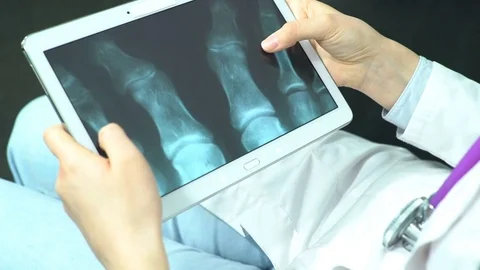 Doctor Use Tablet Computer and Controlling X-Ray Stock Footage 74527170