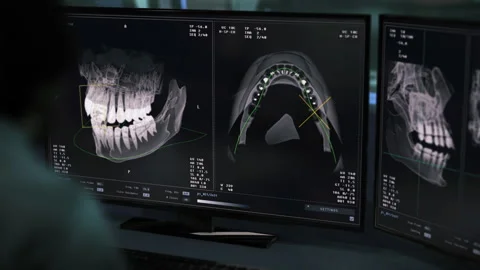 Doctor uses a dental program interface to analyse patients teeth condition Stock Footage 273754438