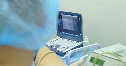A doctor uses a modern sonogram to view vein in sclerotherapy procedure. An Stock Footage 82938767
