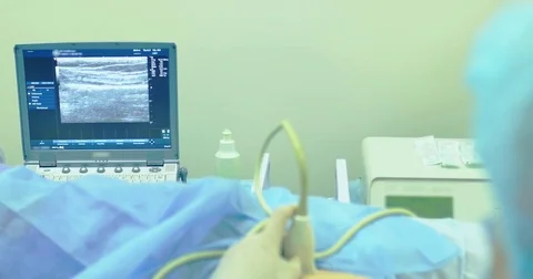 A doctor uses a modern sonogram to view vein in sclerotherapy procedure. An Stock Footage 83086830
