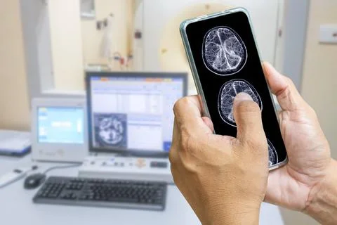 The doctor is using a cell phone to check the patient's brain MRI results. .. Stock Photos