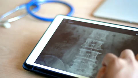 Doctor using  smart device Video stock 148606744