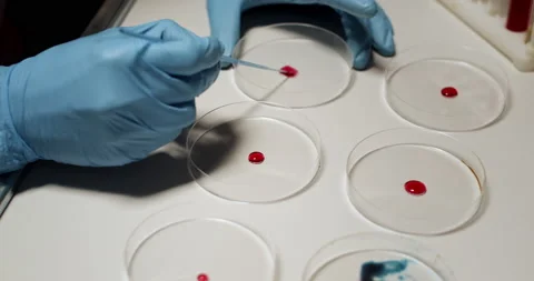 Doctor Working with Blood Tests using Petri Dish. Boold Tests, Virus Test Stock Footage 151139375