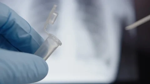 Doctor working with coronavirus test 動画素材 129225662