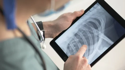 Doctor Working With a Digital Tablet and Looking at X-Ray Scan Of Ribs Stock-Footage 86094508