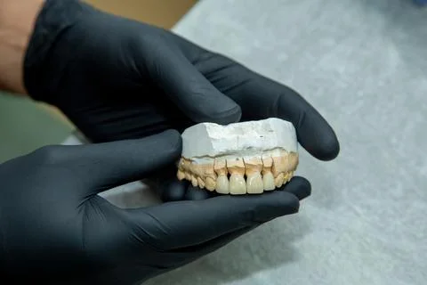 Doctor working with a layout of teeth Stock Photos