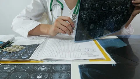 Doctor working with X-rays Stock Footage 87037811