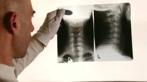 Doctor, X-ray Stock Footage 14844273