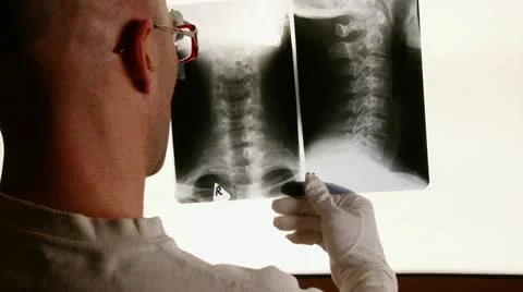 Doctor, X-ray Stock Footage 14847540