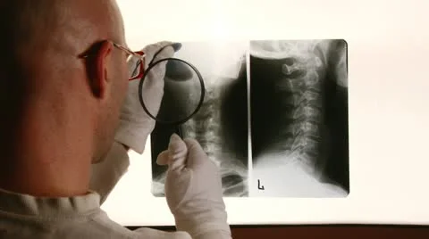 Doctor, X-ray, magnifier Stock Footage 14852053