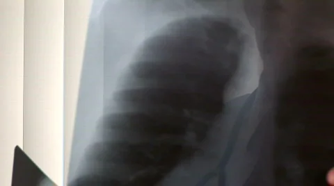 Doctor xray pullback Vídeo Stock 133279