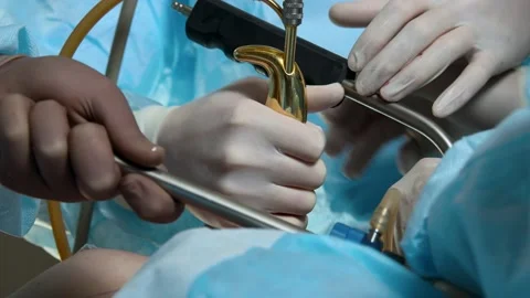 Doctors are performing a complex operation Stock-Footage 166545890