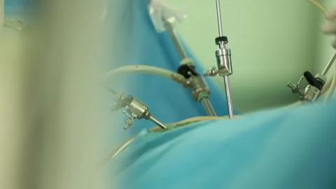 Doctors are performing surgery 4 Stock Footage 317081303
