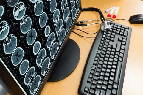 Doctor's computer with x-ray image Foto stock