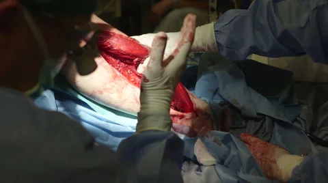 Doctors discussing leg surgery in operating theater Video stock 58247086