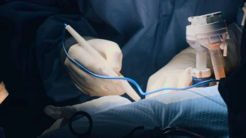 Doctors doing surgery Stock Footage 105822526