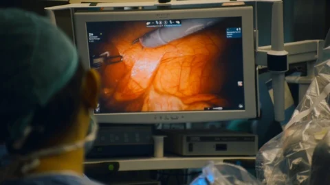 Doctors doing surgery Stock Footage 105824304