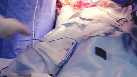 Doctors Doing Surgery Stock Footage 128748157